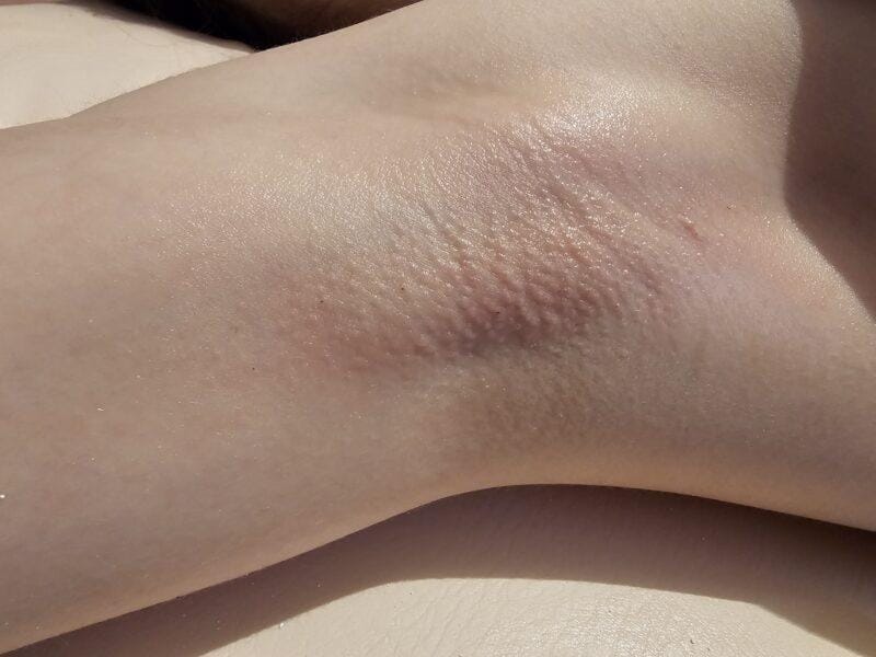 Massage , sugaring